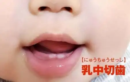 子どもの虫歯予防のために、保育士にできる工夫や取り組みって?